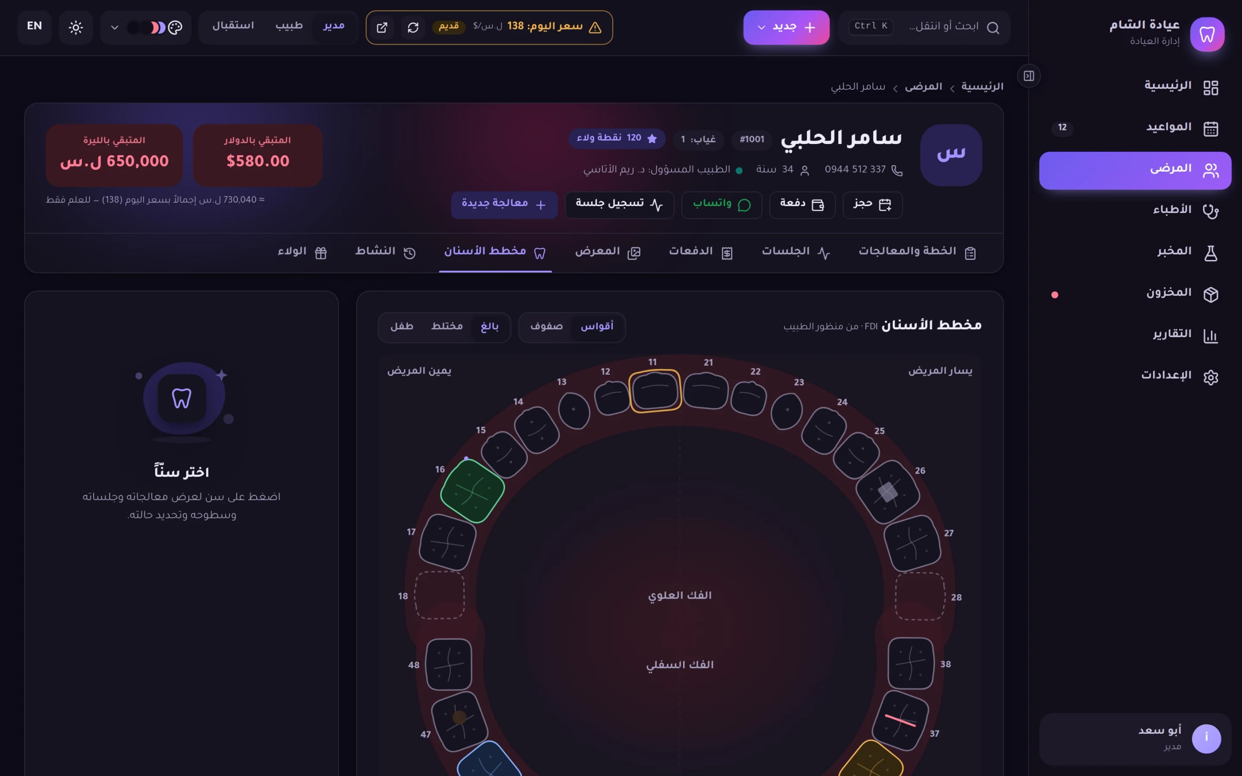 لقطة من برنامج Dentix: مخطط الأسنان