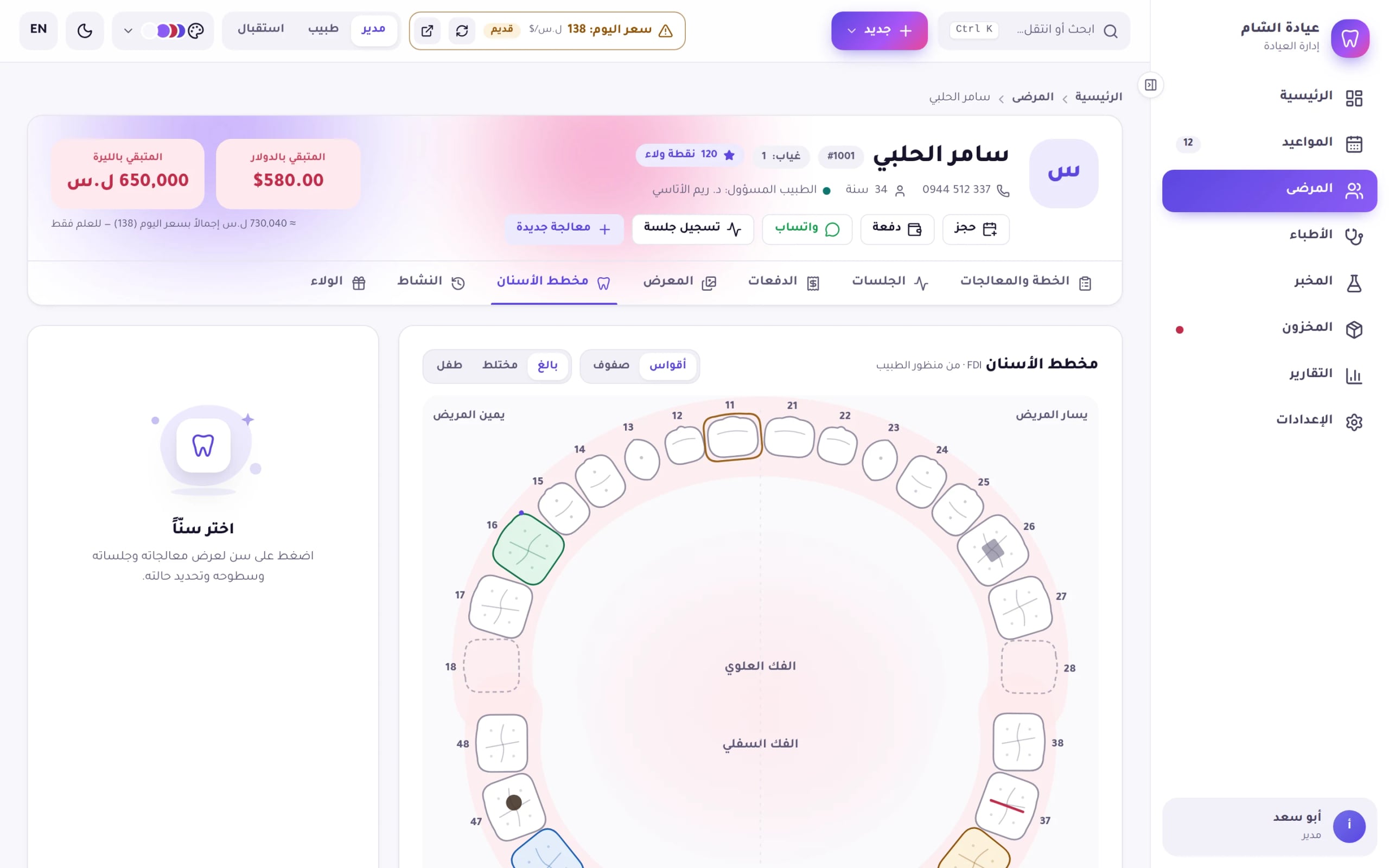 لقطة من برنامج Dentix: مخطط الأسنان