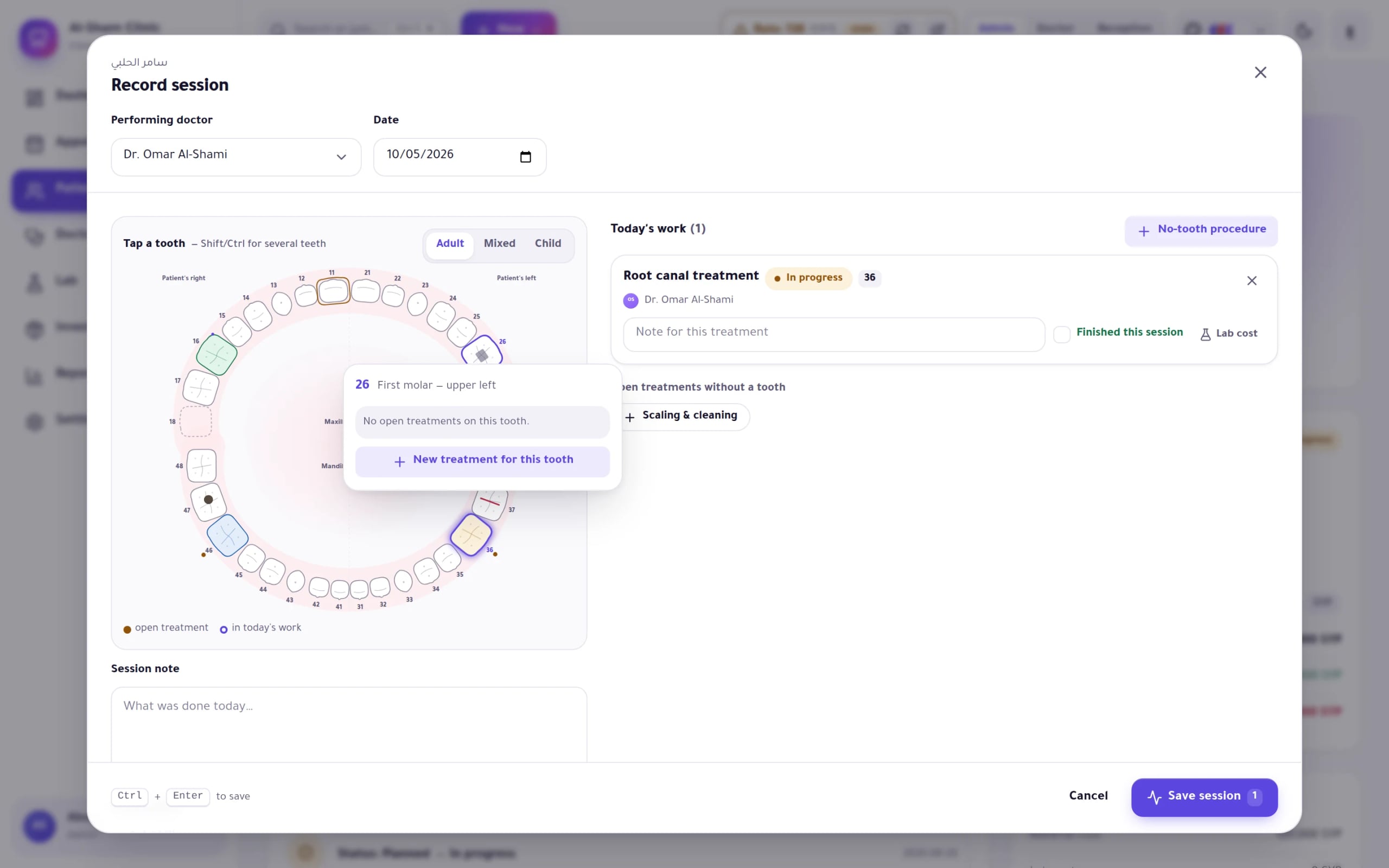 Dentix screenshot: Record-session dialog