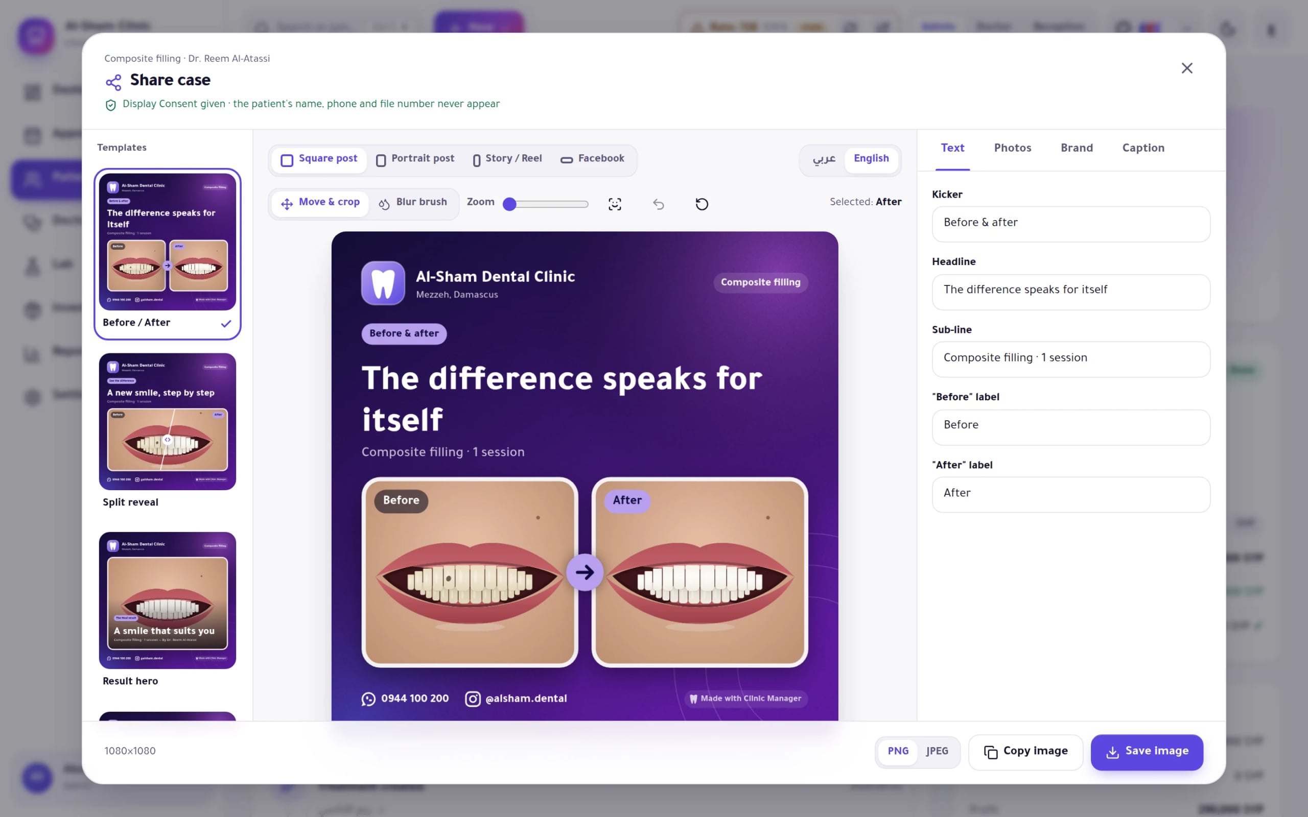 Dentix screenshot: Case-share editor