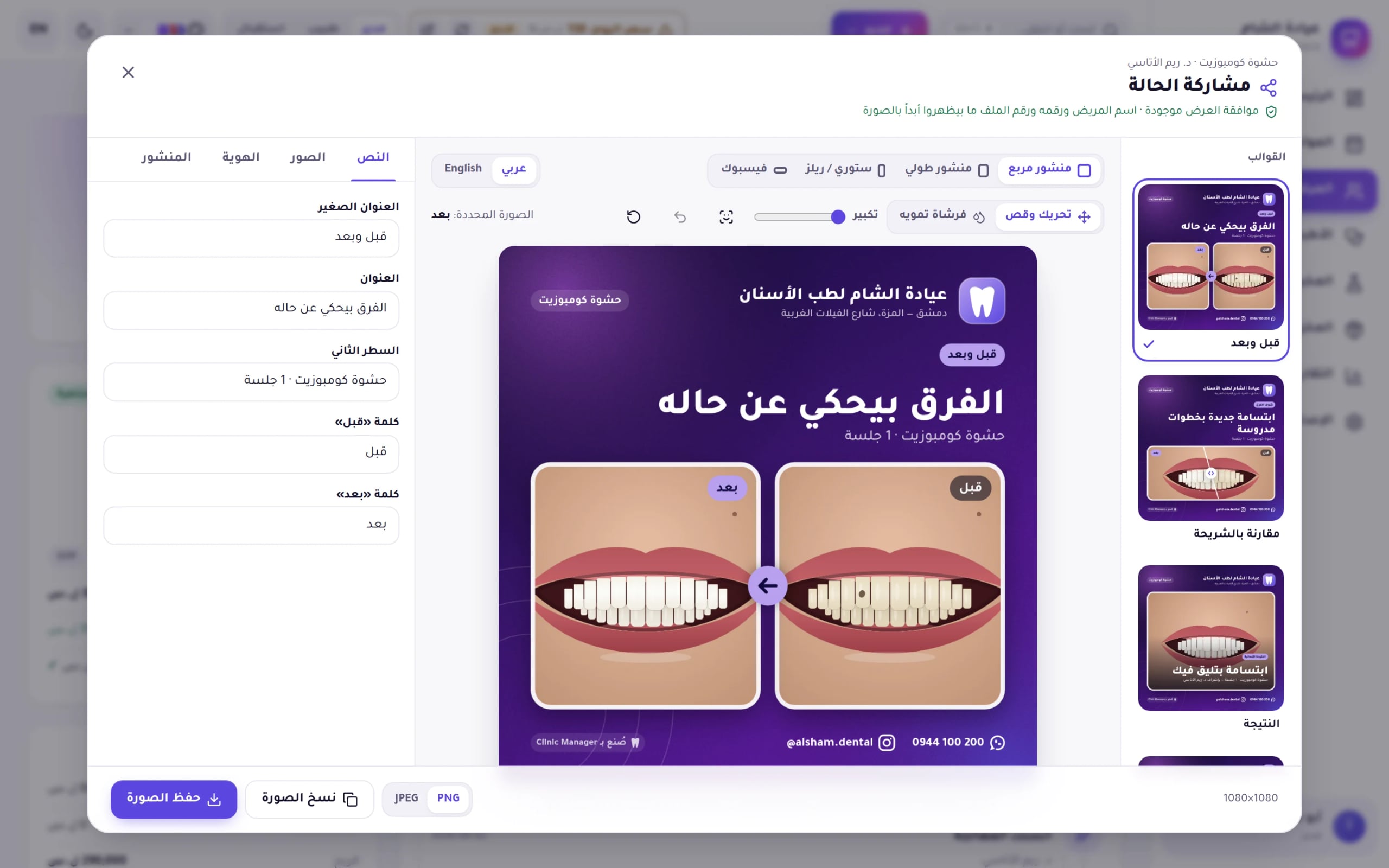 لقطة من برنامج Dentix: محرر مشاركة الحالة